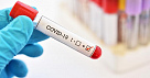 В Туве за неделю зарегистрировано 632 случая заболевания COVID-19